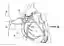 Fig. 01 - Ductus side-entry jackets and prosthetic disorder response systems
