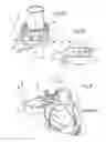 Fig. 08 - Ductus side-entry jackets and prosthetic disorder response systems