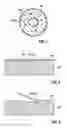Fig. 03 - Medical implant with a fixing device