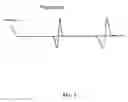 Fig. 03 - Method and system for physiological target localization from macroelectrode recordings and monitoring spinal cord function