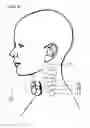 Fig. 09 - Devices and methods for non-invasive capacitive electrical stimulation and their use for vagus nerve stimulation on the neck of a patient