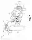 Fig. 08 - Systems and methods for eliciting a stapedial reflex to protect hearing