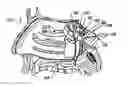 Fig. 05 - Systems and methods for electrical stimulation of sphenopalatine ganglion and other branches of cranial nerves