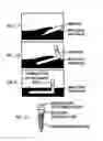 Fig. 09 - Systems and methods for electrical stimulation of sphenopalatine ganglion and other branches of cranial nerves