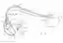 Fig. 01 - Apparatus and methods of adjusting atrioventricular pacing delay intervals in a rate adaptive pacemaker