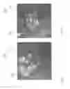 Fig. 02 - Medical implant with contact portions that converts movement from the contact portions into an electrical signal