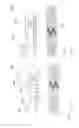 Fig. 04 - Medical implant with contact portions that converts movement from the contact portions into an electrical signal