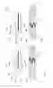 Fig. 05 - Medical implant with contact portions that converts movement from the contact portions into an electrical signal