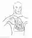 Fig. 01 - Intra cardiac device, system and methods