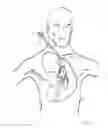 Fig. 18 - Intra cardiac device, system and methods