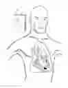 Fig. 25 - Intra cardiac device, system and methods