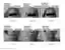 Fig. 17 - Esthetic apparatus useful for increasing skin rejuvenation and methods thereof