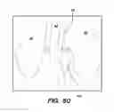 Fig. 44 - SYSTEM AND METHOD FOR OPTOGENETIC THERAPY