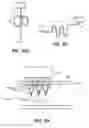 Fig. 87 - SYSTEM AND METHOD FOR OPTOGENETIC THERAPY