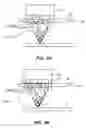 Fig. 88 - SYSTEM AND METHOD FOR OPTOGENETIC THERAPY