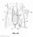 Fig. 42 - SYSTEM AND METHOD FOR OPTOGENETIC THERAPY