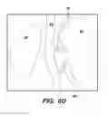 Fig. 44 - SYSTEM AND METHOD FOR OPTOGENETIC THERAPY