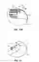 Fig. 82 - SYSTEM AND METHOD FOR OPTOGENETIC THERAPY