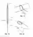 Fig. 85 - SYSTEM AND METHOD FOR OPTOGENETIC THERAPY