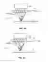 Fig. 88 - SYSTEM AND METHOD FOR OPTOGENETIC THERAPY