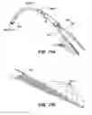 Fig. 79 - System and method for optogenetic therapy