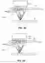 Fig. 88 - System and method for optogenetic therapy
