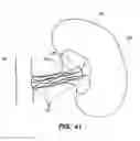 Fig. 35 - System and method for optogenetic therapy