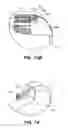 Fig. 82 - System and method for optogenetic therapy