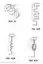 Fig. 86 - System and method for optogenetic therapy