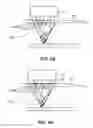 Fig. 88 - System and method for optogenetic therapy
