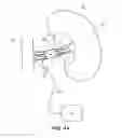 Fig. 38 - System and method for optogenetic therapy