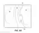 Fig. 44 - System and method for optogenetic therapy