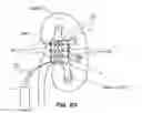 Fig. 74 - System and method for optogenetic therapy