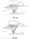 Fig. 88 - System and method for optogenetic therapy