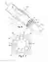 Fig. 05 - Multitube esophageal brachytherapy catheter