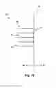 Fig. 09 - Multitube esophageal brachytherapy catheter