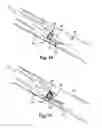Fig. 12 - Multitube esophageal brachytherapy catheter