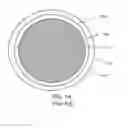 Fig. 02 - Image-guided radiotherapy for internal tumor boost