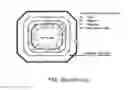 Fig. 03 - Image-guided radiotherapy for internal tumor boost