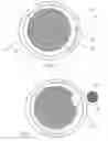 Fig. 04 - Image-guided radiotherapy for internal tumor boost