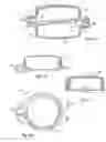 Fig. 05 - Liquid fillable portable exercise apparatus