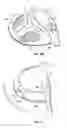 Fig. 07 - Golf club head with adjustable center of gravity
