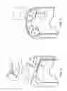 Fig. 10 - Pool cleaner with filter with self cleaning means and high internal pressure