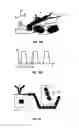Fig. 11 - Device and method for pressure-driven plug transport and reaction