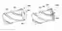 Fig. 01 - Positive relief forming of polycrystalline diamond structures and resulting cutting tools