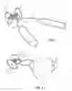 Fig. 02 - Stem Removing Tool