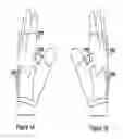 Fig. 02 - Wearable Electronic Signaling Devices