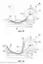 Fig. 06 - Method and apparatus for blind stitching a formed component and components formed from the method