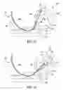 Fig. 07 - Method and apparatus for blind stitching a formed component and components formed from the method