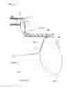 Fig. 16 - Lower limb protecting air bag